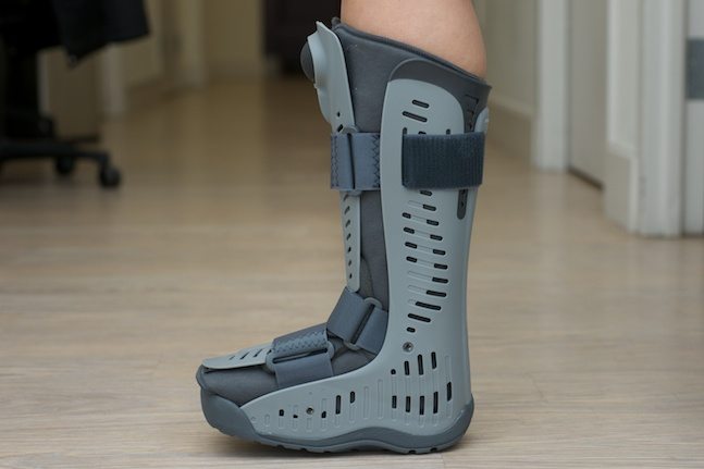 Women Broken Feet with a Grey Plastic Boot Ankle Brace Injury