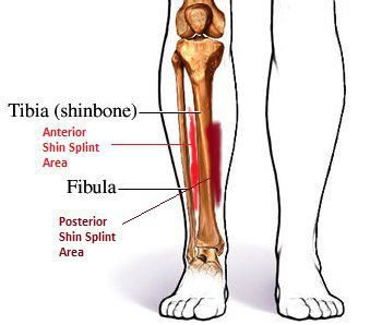 Suffering with Shin Splints, Need Help? Put Your Feet in Our Hands
