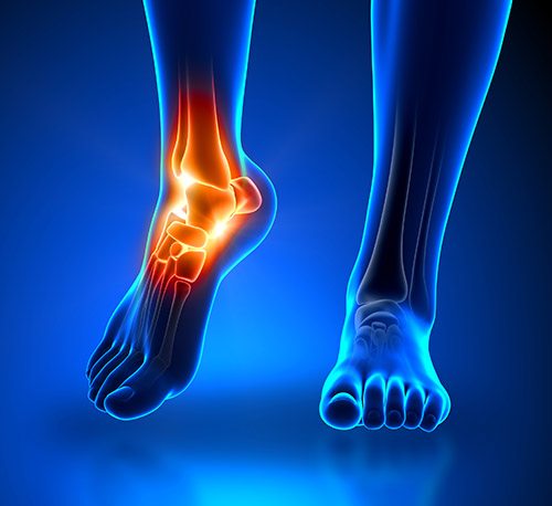 Osteoarthritis and Podiatry - The Foot and Ankle Clinic